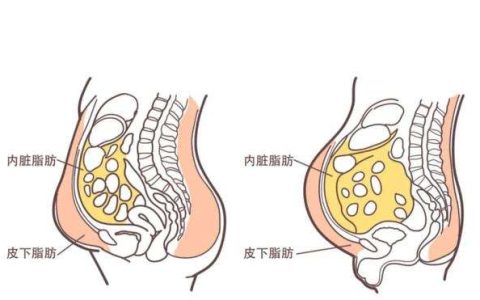 吃什么减内脏脂肪最快（吃出健康吃出美）