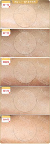 脱毛机十大名牌排行榜(商用脱毛机品牌排行)插图22