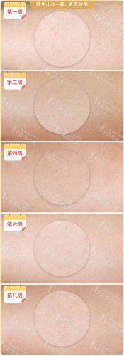 脱毛机十大名牌排行榜(商用脱毛机品牌排行)插图25