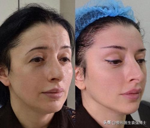 排名前十的是什么美容项目(美容项目一览表)插图