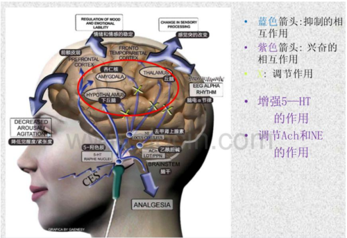 改善睡眠的睡眠仪是真有用还是智商税(睡眠手握仪是智商税吗)插图11