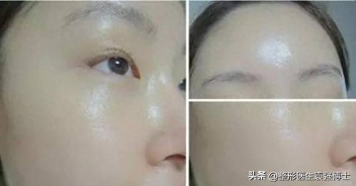 排名前十的是什么美容项目(美容项目一览表)插图1