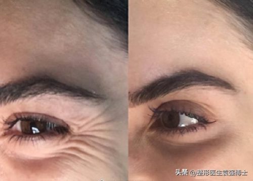 排名前十的是什么美容项目(美容项目一览表)插图2