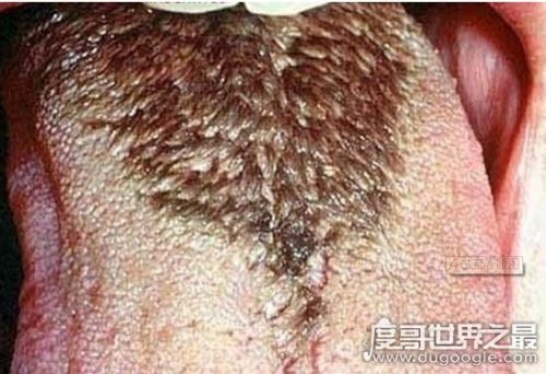 密集恐惧症大揭秘(密集恐惧症普遍么)插图12