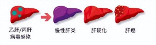 乙肝五项医院排名前十(十大最好的乙肝医院)插图14