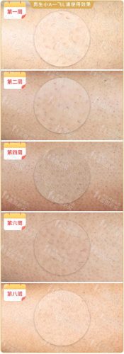 脱毛机十大名牌排行榜(商用脱毛机品牌排行)插图20