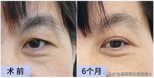 排名前十的是什么美容项目(美容项目一览表)插图3