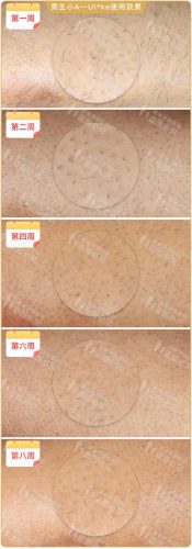 脱毛机十大名牌排行榜(商用脱毛机品牌排行)插图23