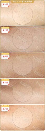 脱毛机十大名牌排行榜(商用脱毛机品牌排行)插图28