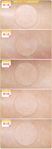 脱毛机十大名牌排行榜(商用脱毛机品牌排行)插图24