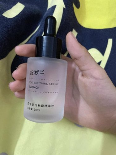 去雀斑十大排行榜(十大最好的雀斑)插图1