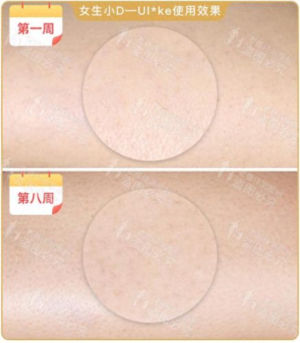 脱毛机十大名牌排行榜(商用脱毛机品牌排行)插图19
