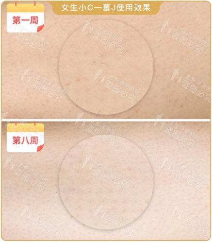 脱毛机十大名牌排行榜(商用脱毛机品牌排行)插图13
