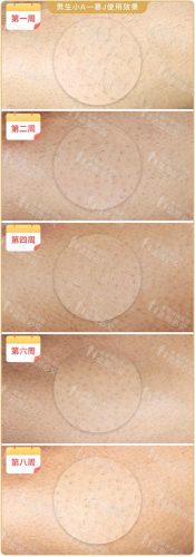脱毛机十大名牌排行榜(商用脱毛机品牌排行)插图21