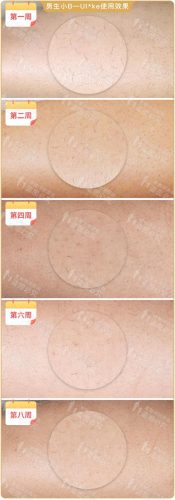 脱毛机十大名牌排行榜(商用脱毛机品牌排行)插图27