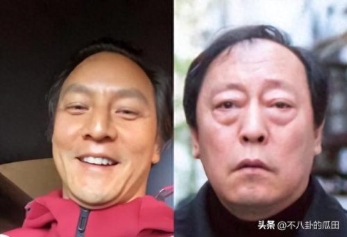 秃顶明星排名前十(秃顶吃什么药可以生发)插图27