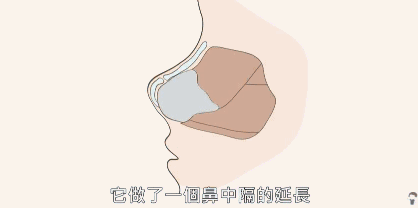 道晖芝整容(道晖芝以前照片)插图17
