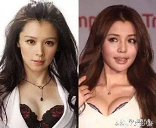 李毓芬整容(李毓芬长得像谁)插图25