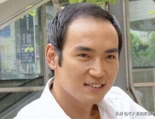 秃顶明星排名前十(秃顶吃什么药可以生发)插图30