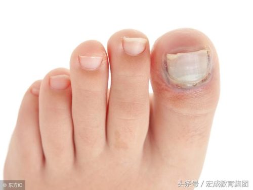100种皮肤病对照图(微信扫一扫识别皮肤病)插图6
