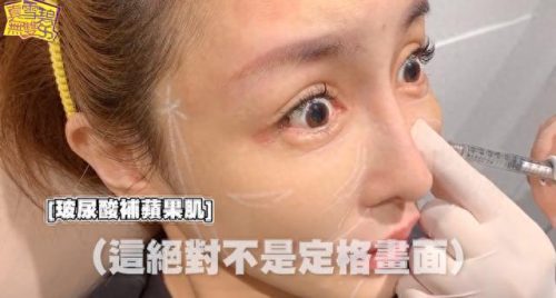明星痛苦的录影经验(明星焦虑症痛苦经历)插图4