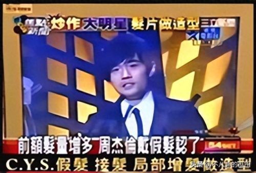 秃顶明星排名前十(秃顶吃什么药可以生发)插图6