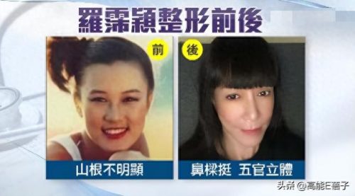 陈意涵整容(创造101陈意涵整容了吗)插图8