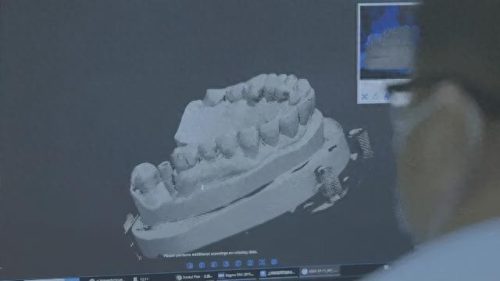 上海排名前十齿科加工(上海正睿齿科排名多少)插图4