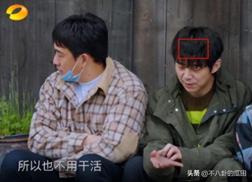 秃顶明星排名前十(秃顶吃什么药可以生发)插图15
