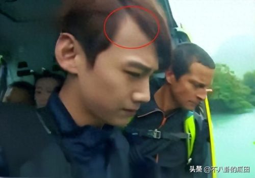 秃顶明星排名前十(秃顶吃什么药可以生发)插图16