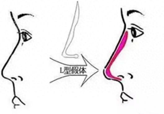 道晖芝整容(道晖芝以前照片)插图15