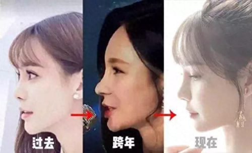 道晖芝整容(道晖芝以前照片)插图7