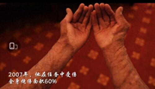 呵护星(40-50岁护肤品推荐)插图9