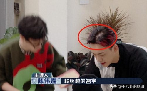 秃顶明星排名前十(秃顶吃什么药可以生发)插图9