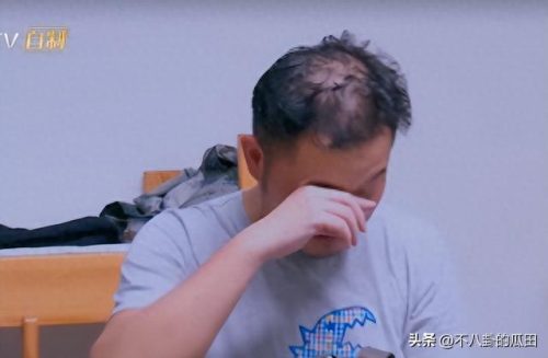 秃顶明星排名前十(秃顶吃什么药可以生发)插图18