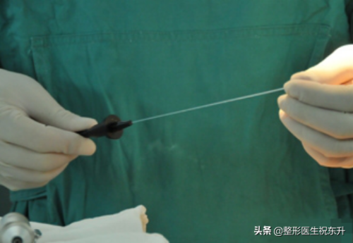 激光溶脂瘦腿(小腿吸脂减肥)插图2