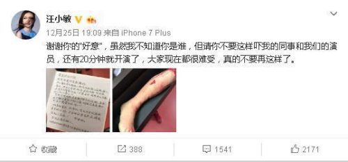 汪小敏整容前后照片(汪小敏容貌变化)插图1