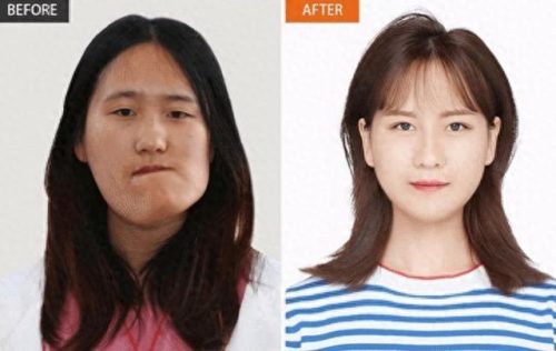 郭明义的故事(鞍钢新闻郭明义)插图6