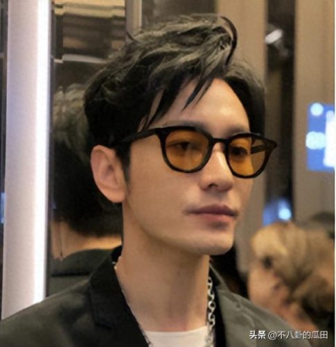 秃顶明星排名前十(秃顶吃什么药可以生发)插图
