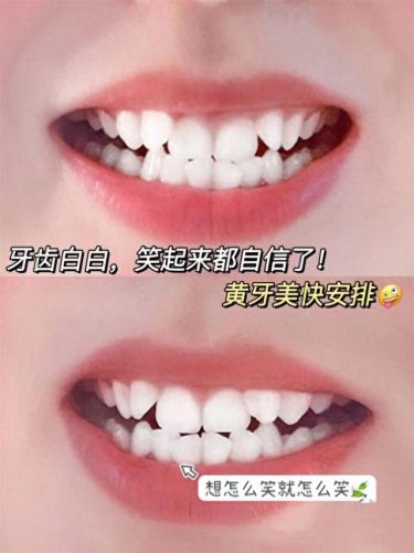 戒烟牙膏厂家排名前十(中国十大老牌牙膏)插图3