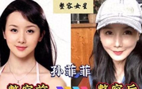 孙菲菲整容前(孙菲菲毁容图片)
