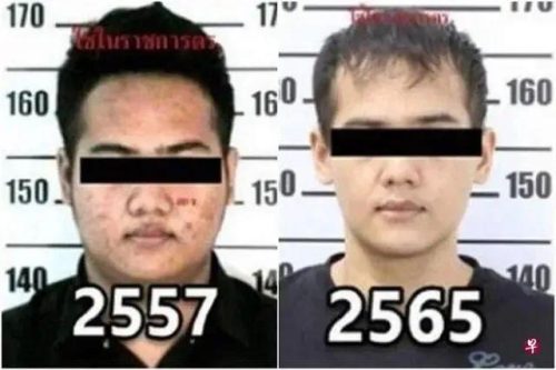 韩国男明星整容前后(韩国整容价格)插图