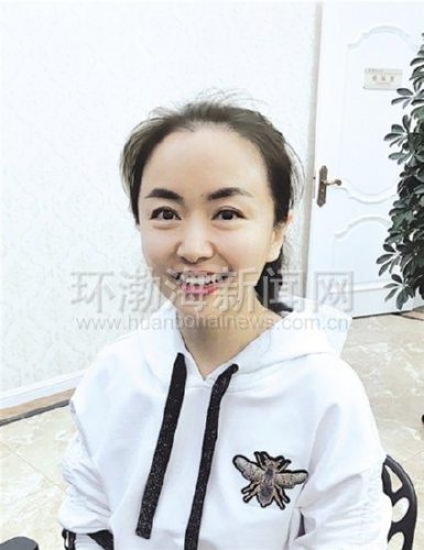 开封隆鼻医生排名前十(郑州做鼻子比较好的医生)插图1