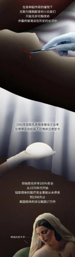 隆胸美国明星排名前十(法国隆胸假体)插图5