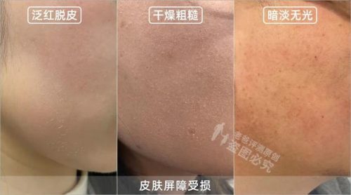 哪种护肤品抗皱好(十大骗人祛皱产品)插图2