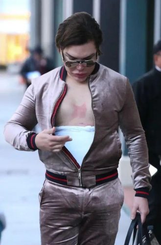男人整容(男人可以整容吗)插图36