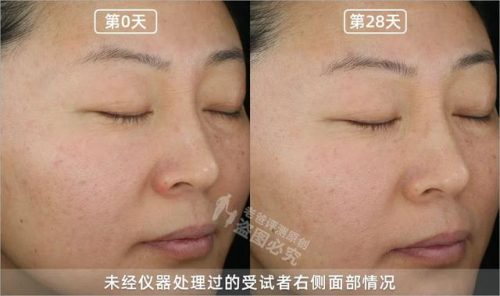 哪种护肤品抗皱好(十大骗人祛皱产品)插图18