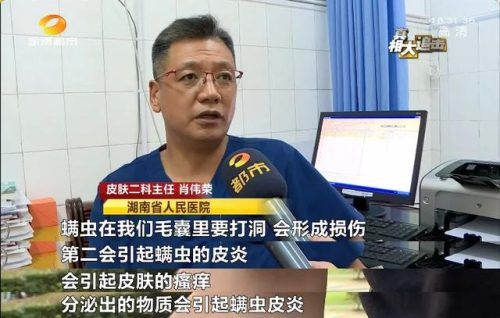 除螨器去螨虫(央视测评除螨仪排行)插图2