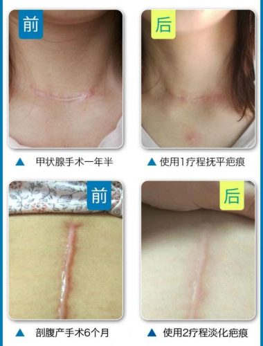 激光美容哪家医院最好(三甲医院激光收费标准)插图2