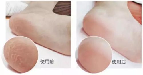 英国好用护垫排名前十(哪个品牌女性护垫最好用)插图9